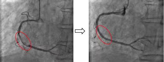 20230110-绿色通道3-医院供稿-医院供稿jpg 20230110-绿色通道3-医院供稿-医院供稿jpg